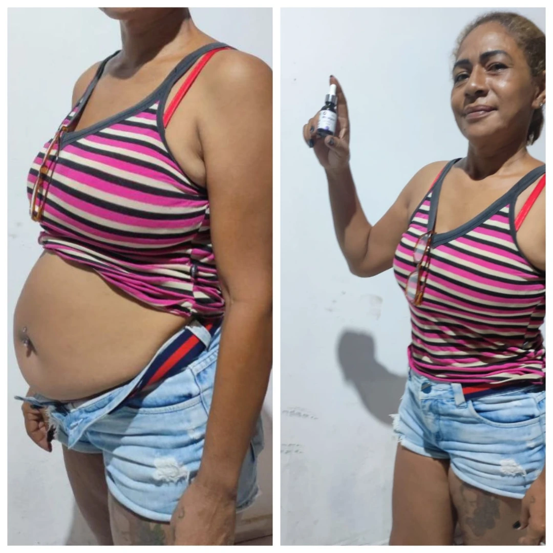 Resultado real cliente Mounjax — antes e depois 1